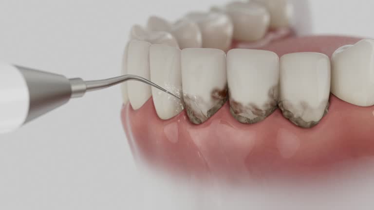 Reliable Emergency Dentist contractor in Warner, OK by Smile Center Dentistry